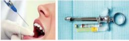 胰島素，牙科麻醉6.png